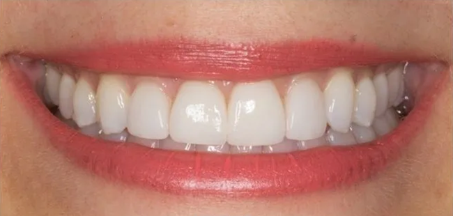 After Dental Transformation