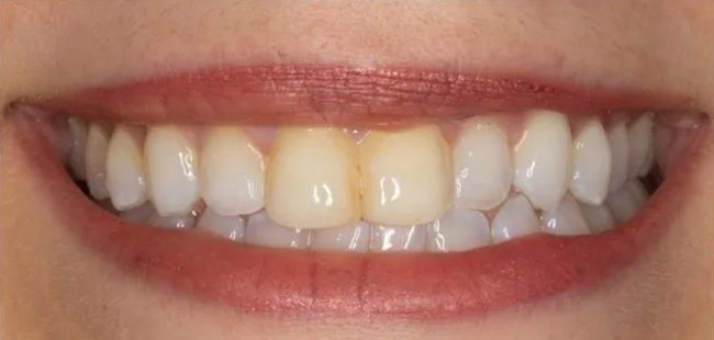 Before Dental Transformation