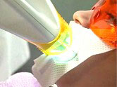 A light is directed at a woman's smile to activate the bleaching agent during a Zoom whitening treatment.