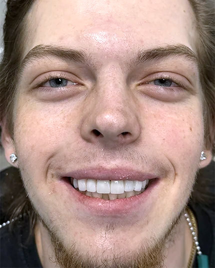 Full-face picture of Hayden after Dr. Cameron finished his dental work.