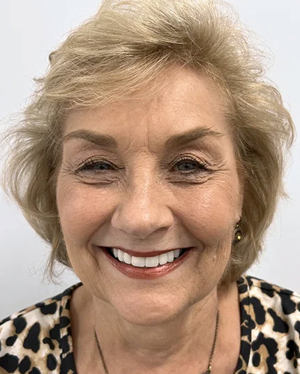 Full-face picture of Linda after Dr. Cameron completed her dental work.