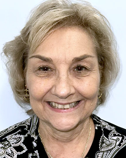 Full-face picture of Linda before Dr. Cameron began her dental work.