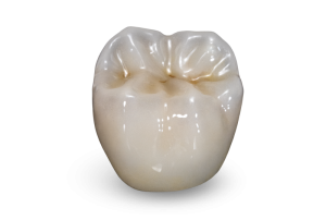 Photo of a BruxZir Full-Strength Zirconia crown.