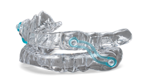 Photo of the Silent Nite mandibular advancement device, a non-surgical treatment for snoring and sleep apnea.