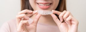 Photo of a woman holding a plastic tray for at-home teeth whitening.